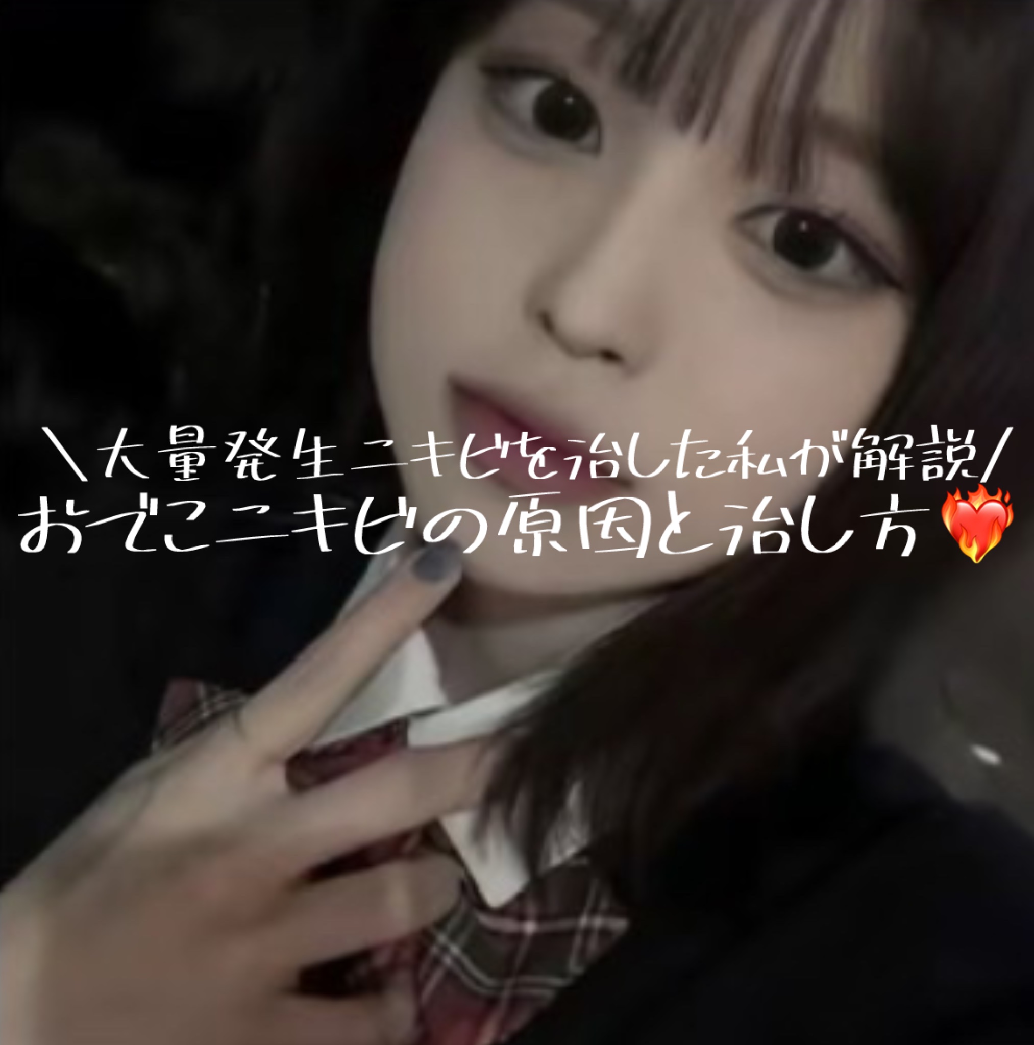 メンソレータムアクネス 薬用クリーム洗顔/メンソレータム アクネス/洗顔フォームを使ったクチコミ（1枚目）