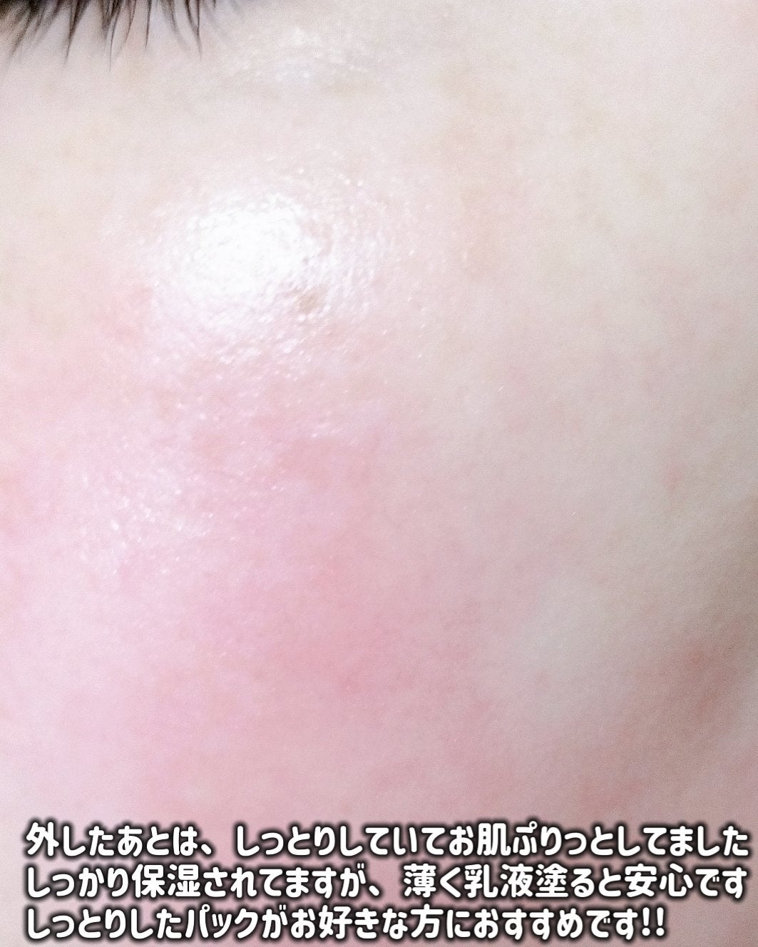 ブラックPDRN デイリーシートマスク/ネイチャーリパブリック/シートマスク・パックを使ったクチコミ(7枚目)