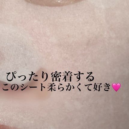 ルルルン ハイドラ V マスク/ルルルン/シートマスク・パックを使ったクチコミ(5枚目)