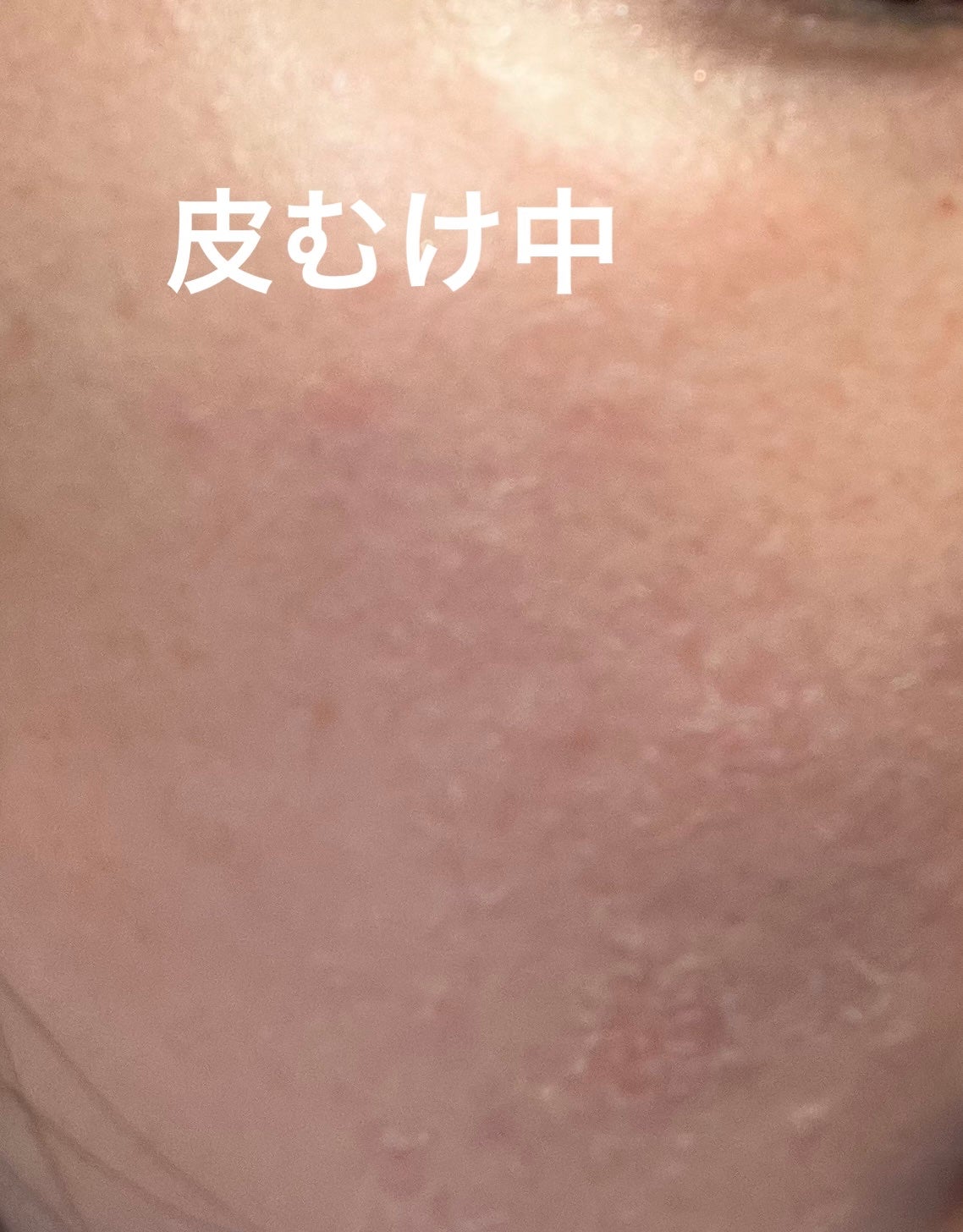 デイリーPD/ZO Skin Health/フェイスクリームを使ったクチコミ(5枚目)