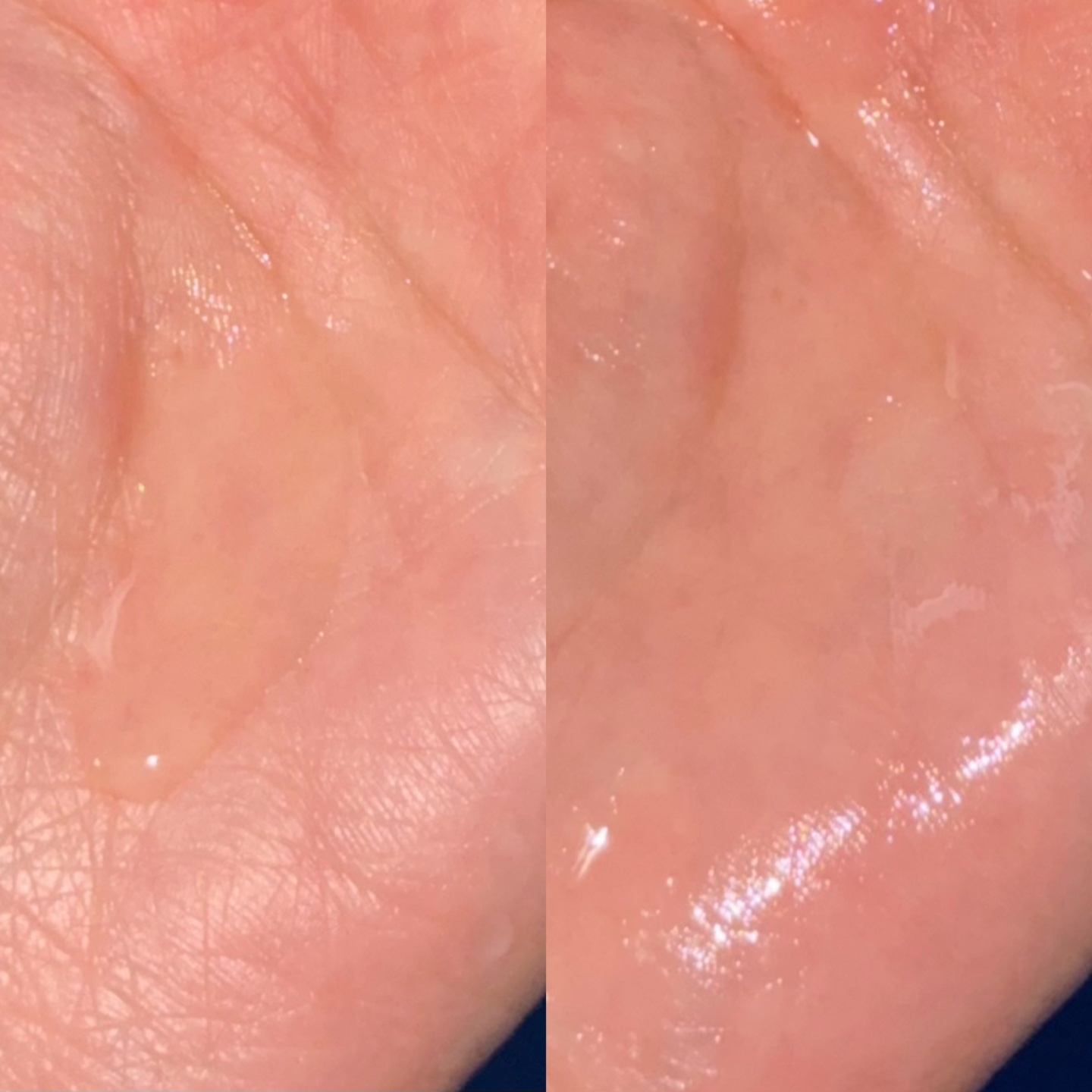 肌美精 薬用美白化粧水 [医薬部外品]/肌美精/化粧水を使ったクチコミ（2枚目）