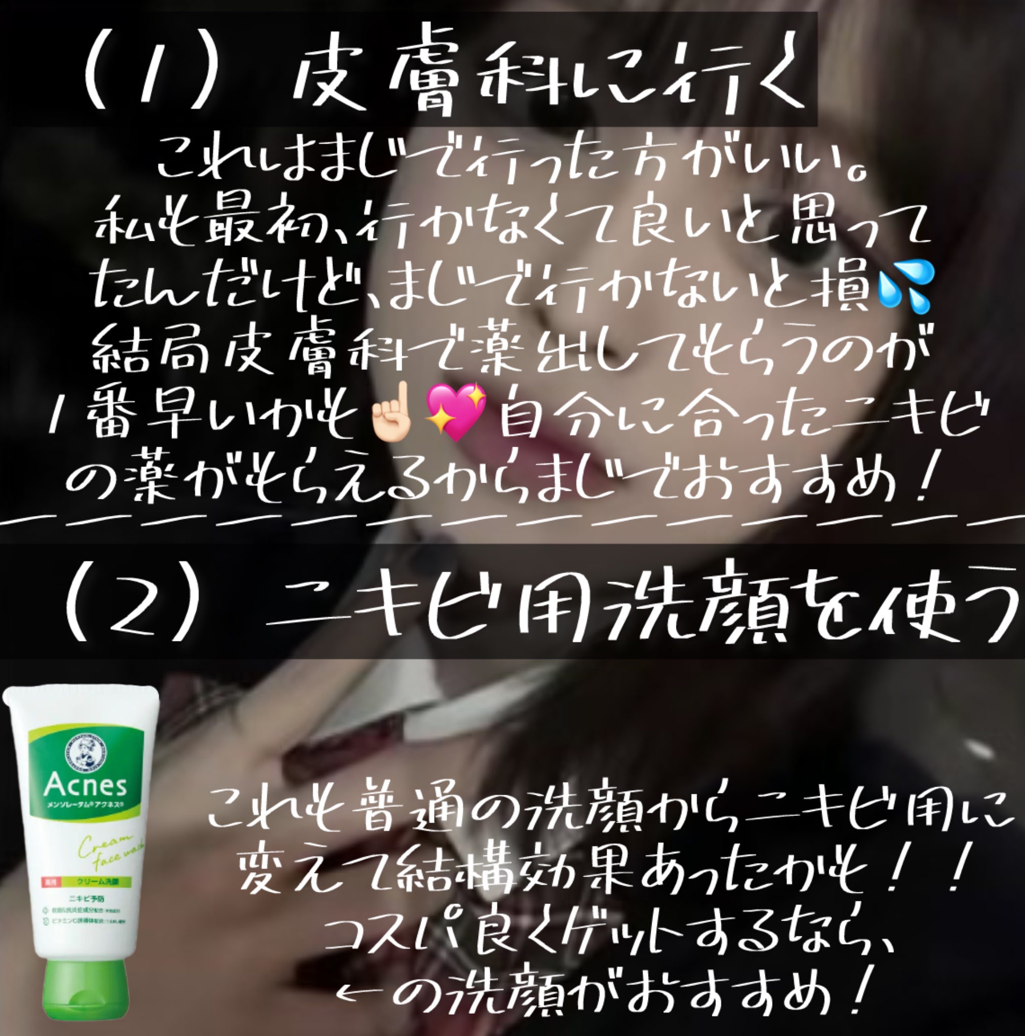 メンソレータムアクネス 薬用クリーム洗顔/メンソレータム アクネス/洗顔フォームを使ったクチコミ（3枚目）