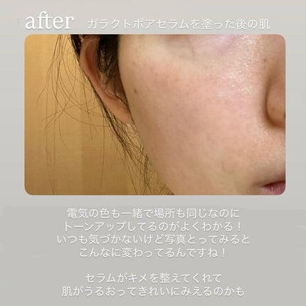 サミュ ガラクトポア セラム/SAM'U/美容液を使ったクチコミ(4枚目)