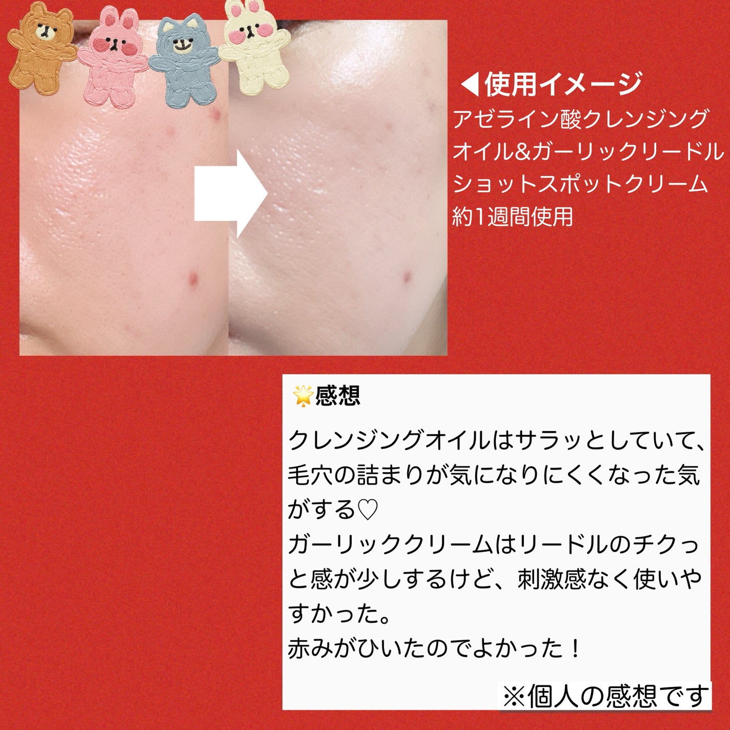 AZケア クレンジングオイル/VT/オイルクレンジングを使ったクチコミ(4枚目)