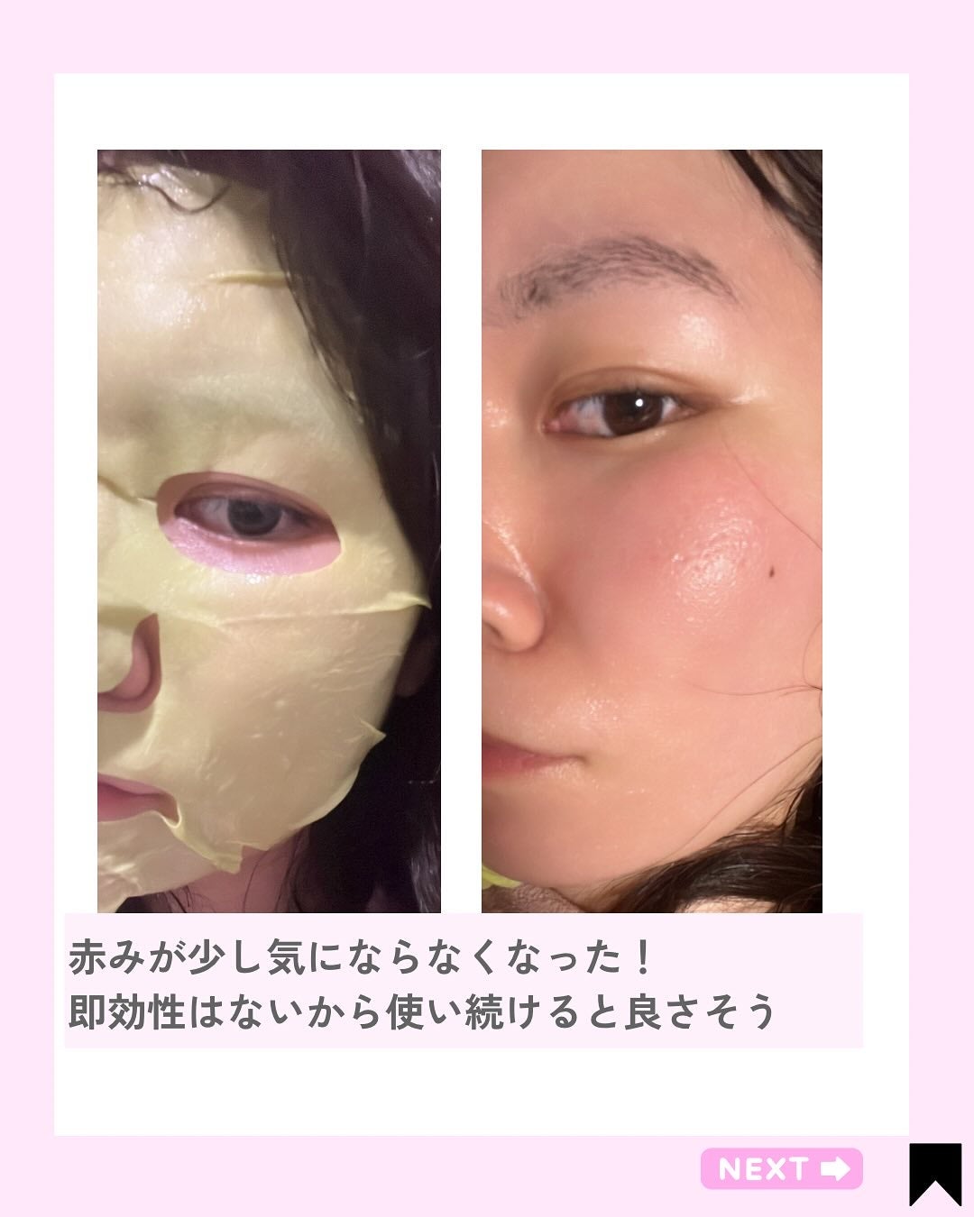 ACディープ クールカーミング マスク/DEWYTREE/シートマスク・パックを使ったクチコミ(6枚目)