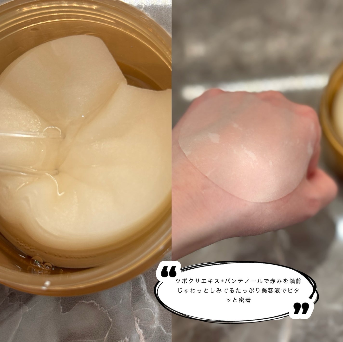 センテラ クイックカーミングパッド/SKIN1004/トナーパッドを使ったクチコミ(3枚目)