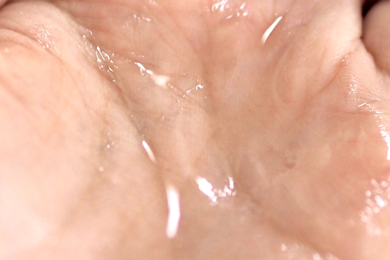 RXザ・アルファアルブチン2 ニキビ跡ケアセラム/COSRX/美容液を使ったクチコミ(5枚目)