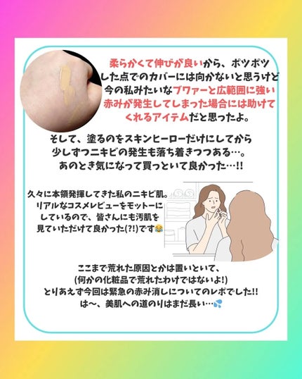 薬用スポットシーラークリーム/スキンヒーロー/クリームコンシーラーを使ったクチコミ(5枚目)