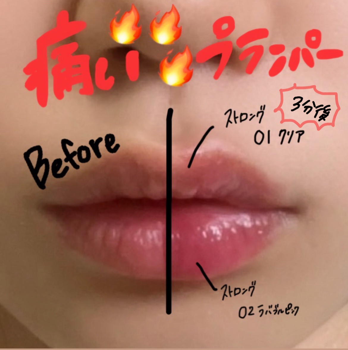 ウォーターフルリッププランパー/COSNORI/リッププランパーを使ったクチコミ（1枚目）