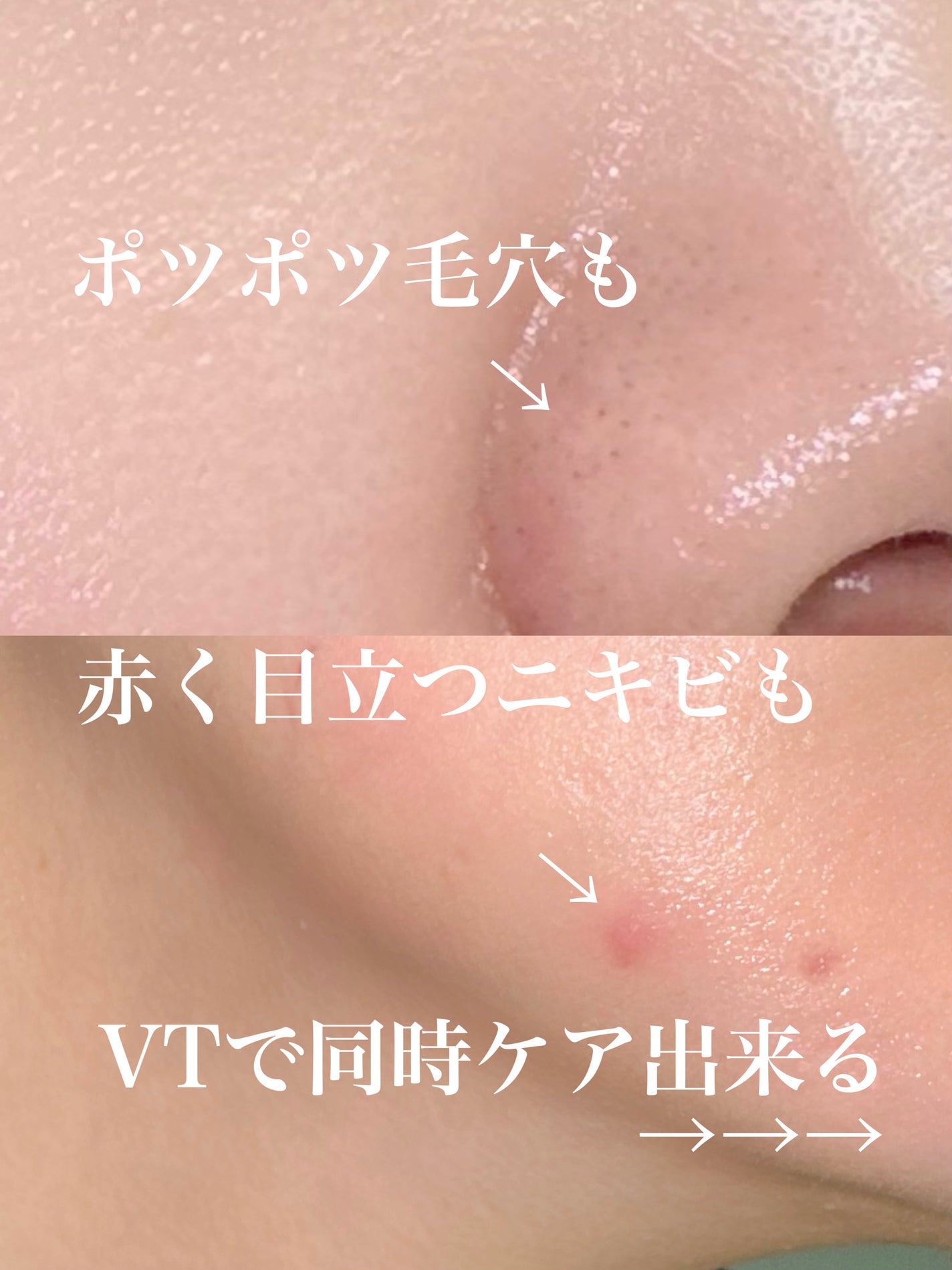 AZケア クレンジングオイル/VT/オイルクレンジングを使ったクチコミ(2枚目)