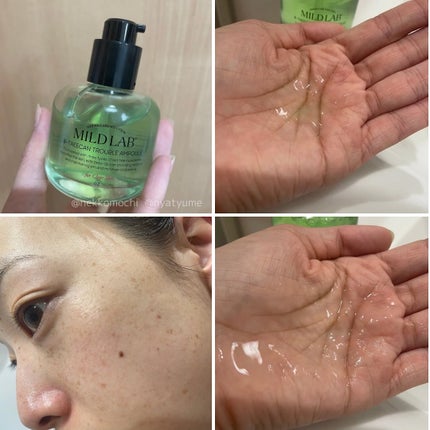 ベターツリカン肌荒れ美容液/Mildlab/美容液を使ったクチコミ(4枚目)