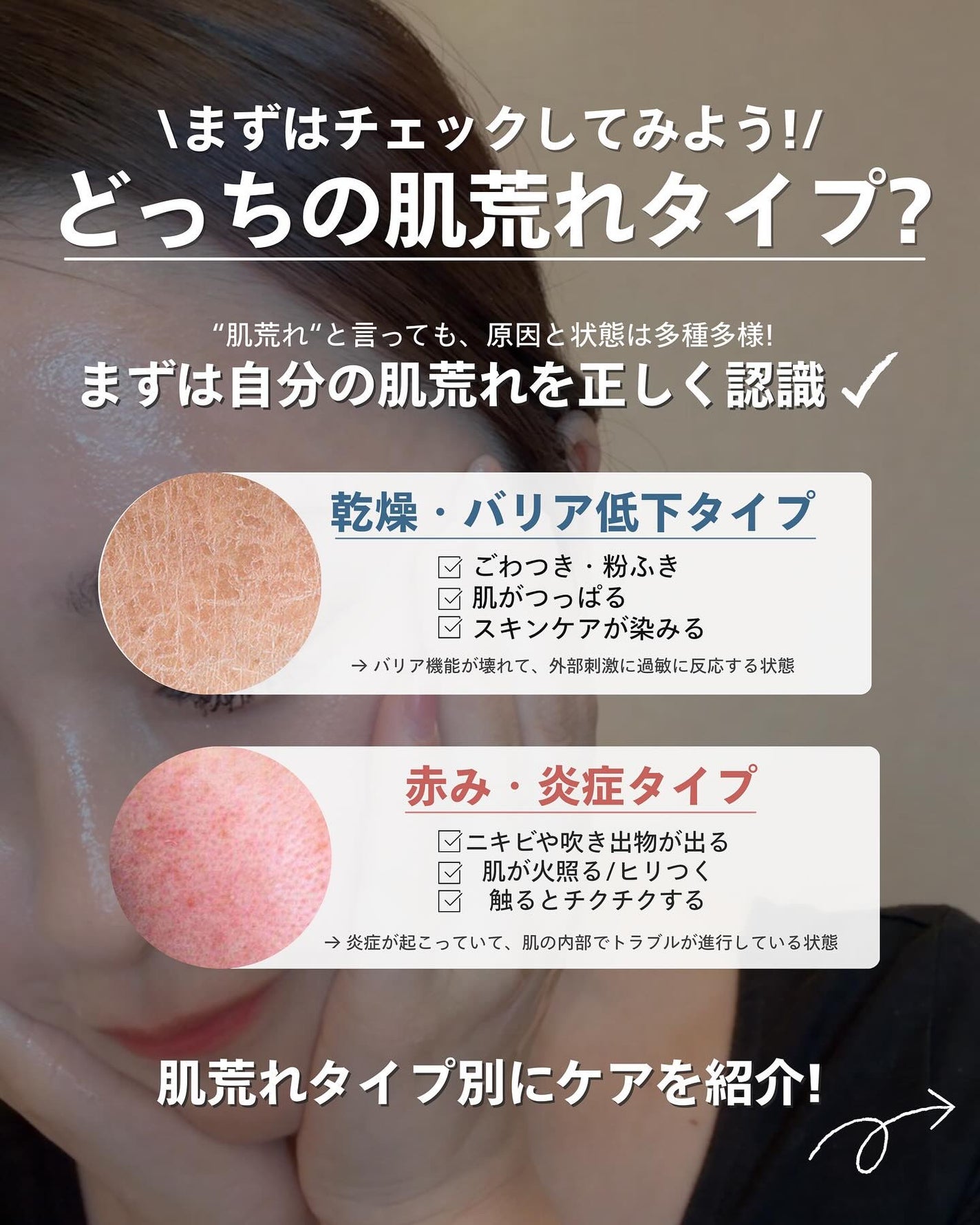 ナラ|毛穴ケアオタク🍓 on LIPS 「(毛穴を綺麗にする方法→@keana_nara)..こんばんは..」(2枚目)