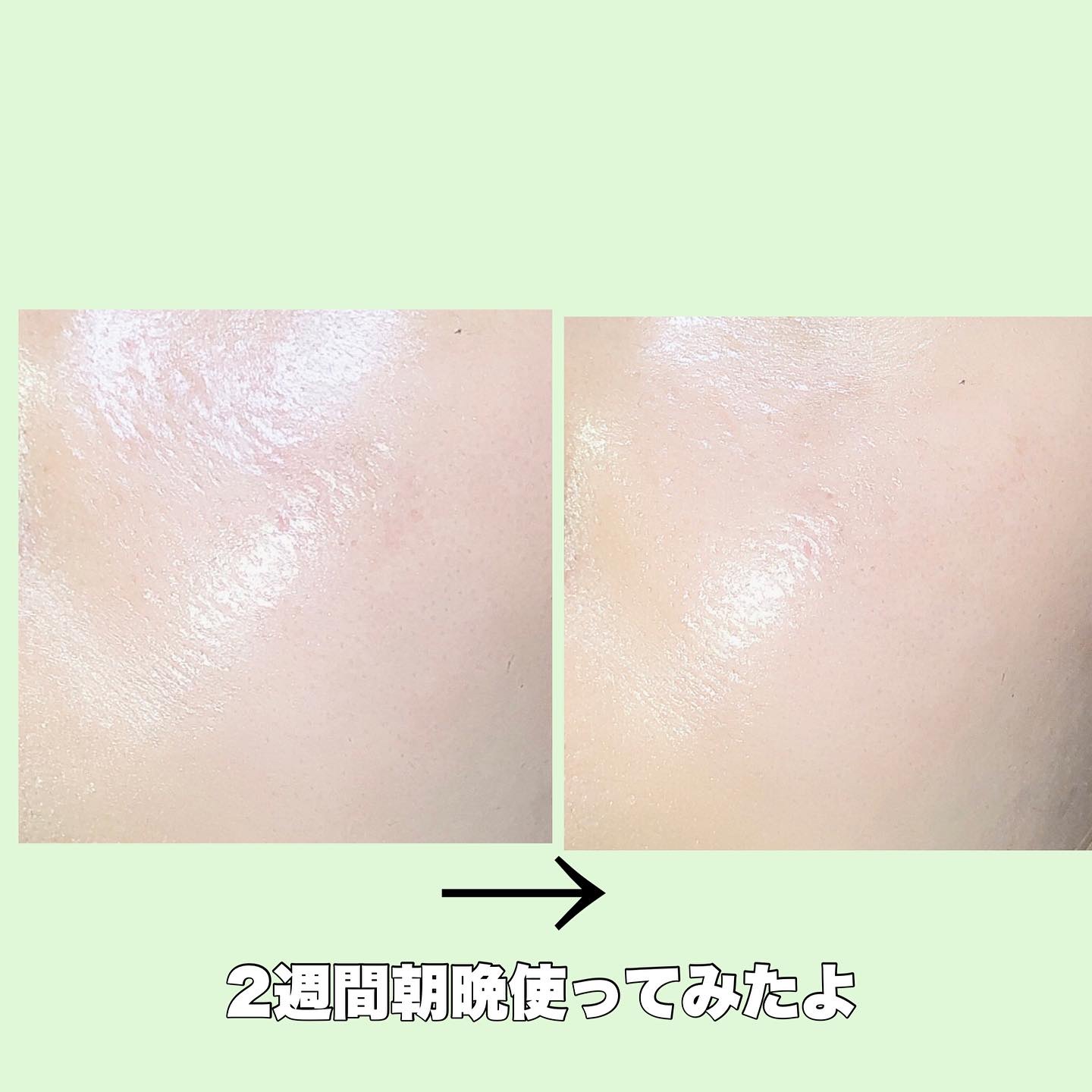 サミュ ガラクトポア セラム/SAM'U/美容液を使ったクチコミ（3枚目）