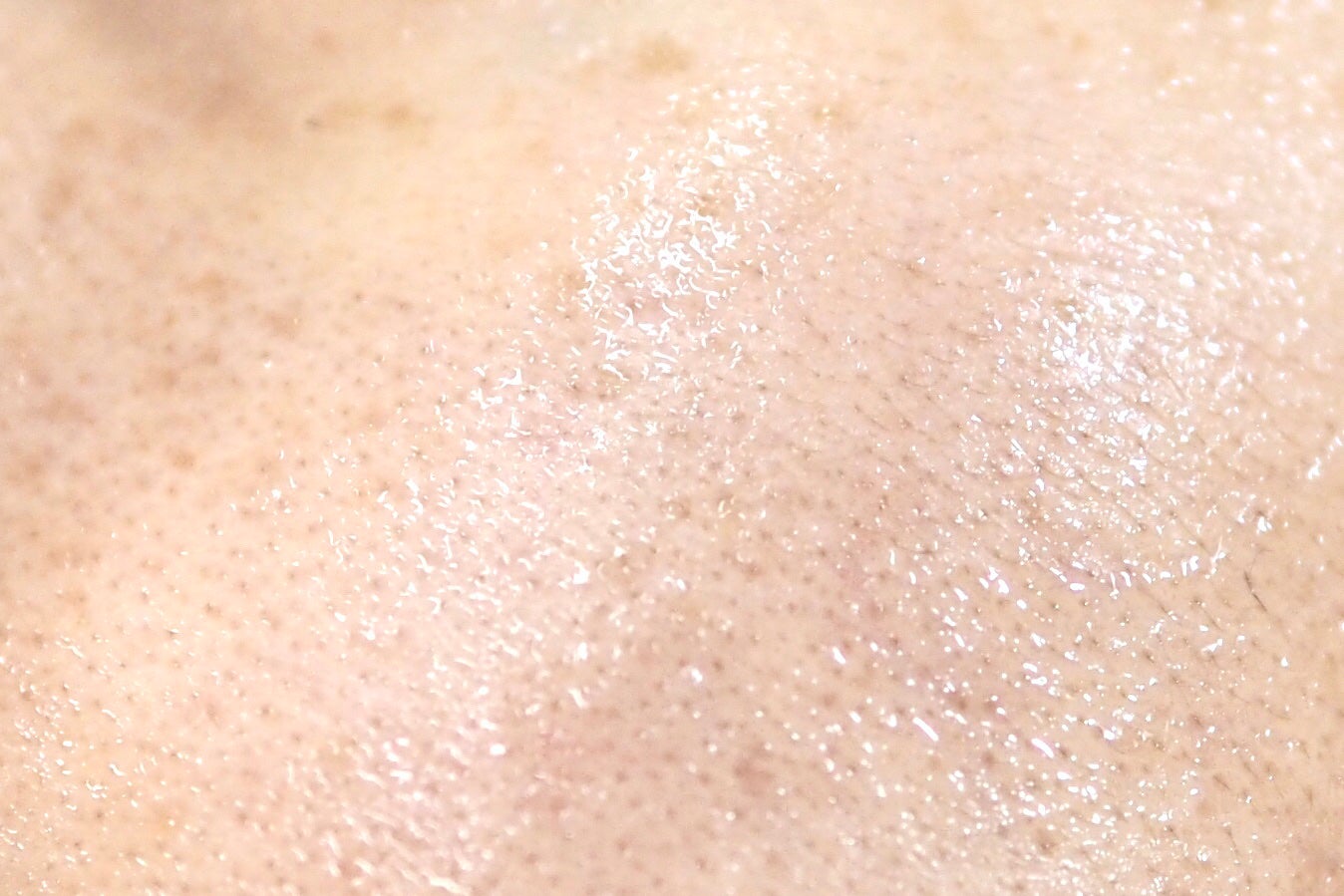 RXザ・アルファアルブチン2 ニキビ跡ケアセラム/COSRX/美容液を使ったクチコミ(6枚目)