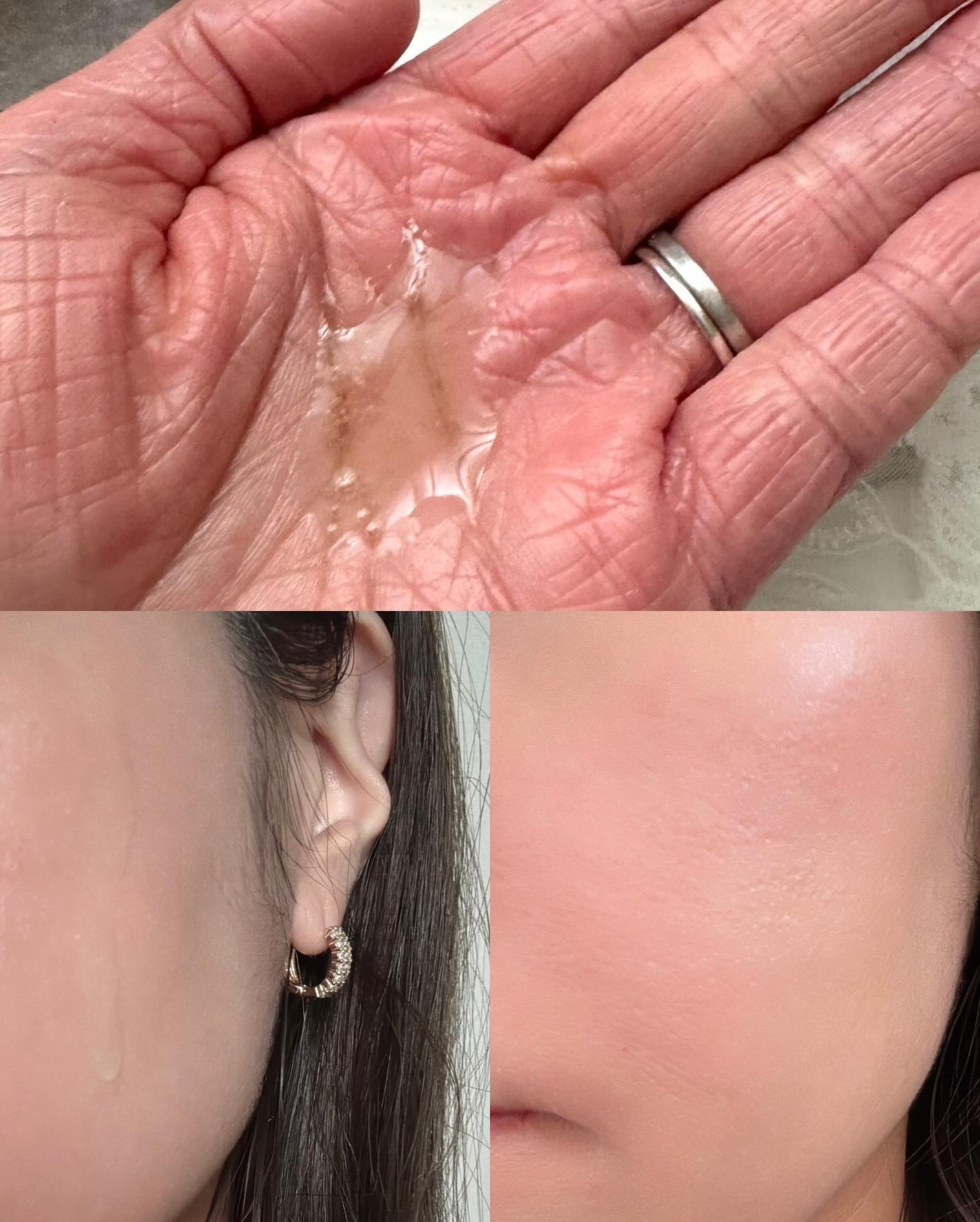 arisya08 on LIPS 「Mildlab(マイルドラボ)💚ベターツリカン肌荒れ美容液み..」(5枚目)