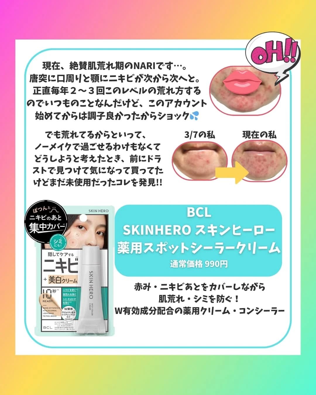 スキンヒーロー 薬用スポットシーラークリームのクチコミ「ニキビ肌・毛穴肌のリアルなコスメレビューを発信しているNARIです🌸

最近なかなか頻繁に更新.....」（2枚目）