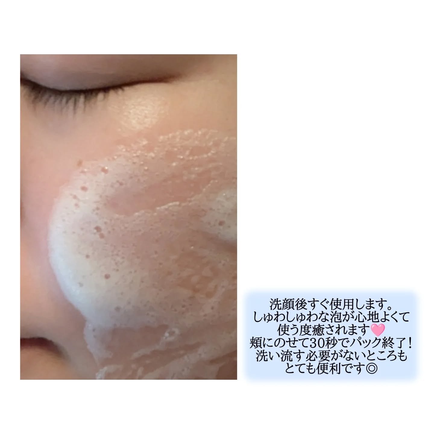 30秒クイックバブルマスク95ml リフト/MENOKIN/シートマスク・パックを使ったクチコミ（3枚目）