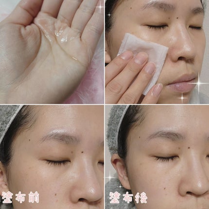 バランシングローション /アカラン/化粧水を使ったクチコミ(2枚目)