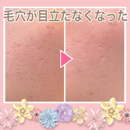 サミュ ガラクトポア セラム/SAM'U/美容液を使ったクチコミ(2枚目)