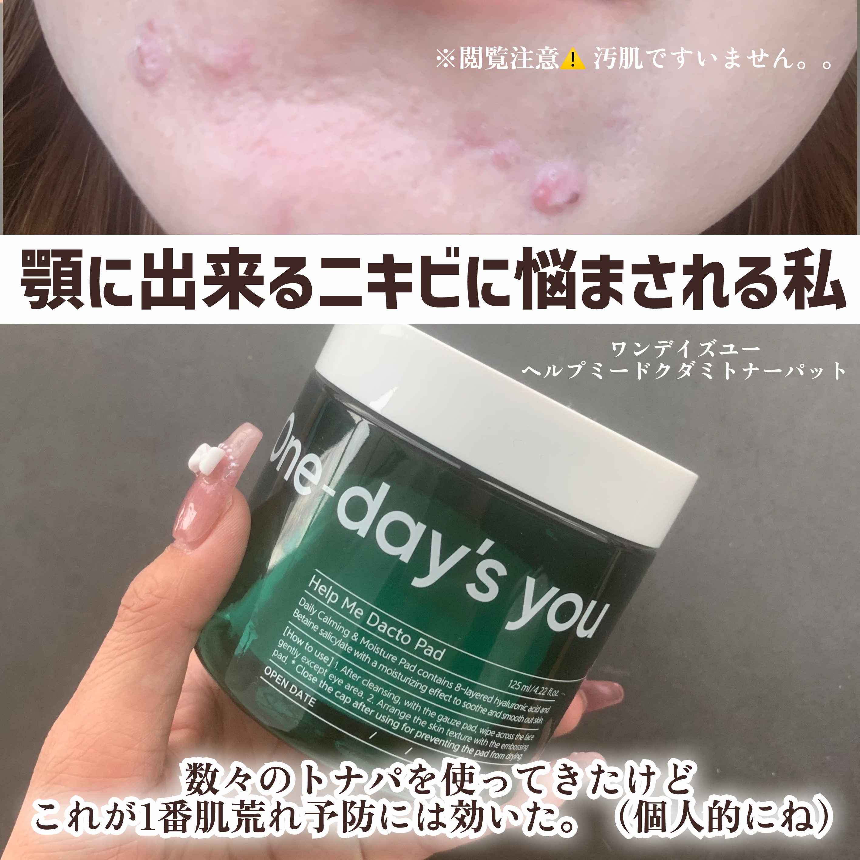 ヘルプミー! ダクトパッド/One-day's you/トナーパッドを使ったクチコミ（2枚目）
