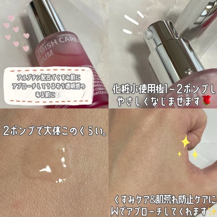 ブレミッシュケアアップ セラム/ISOI/美容液を使ったクチコミ(3枚目)