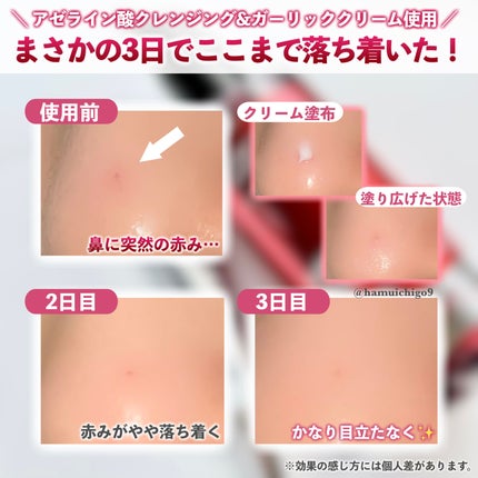 AZケア クレンジングオイル/VT/オイルクレンジングを使ったクチコミ(5枚目)