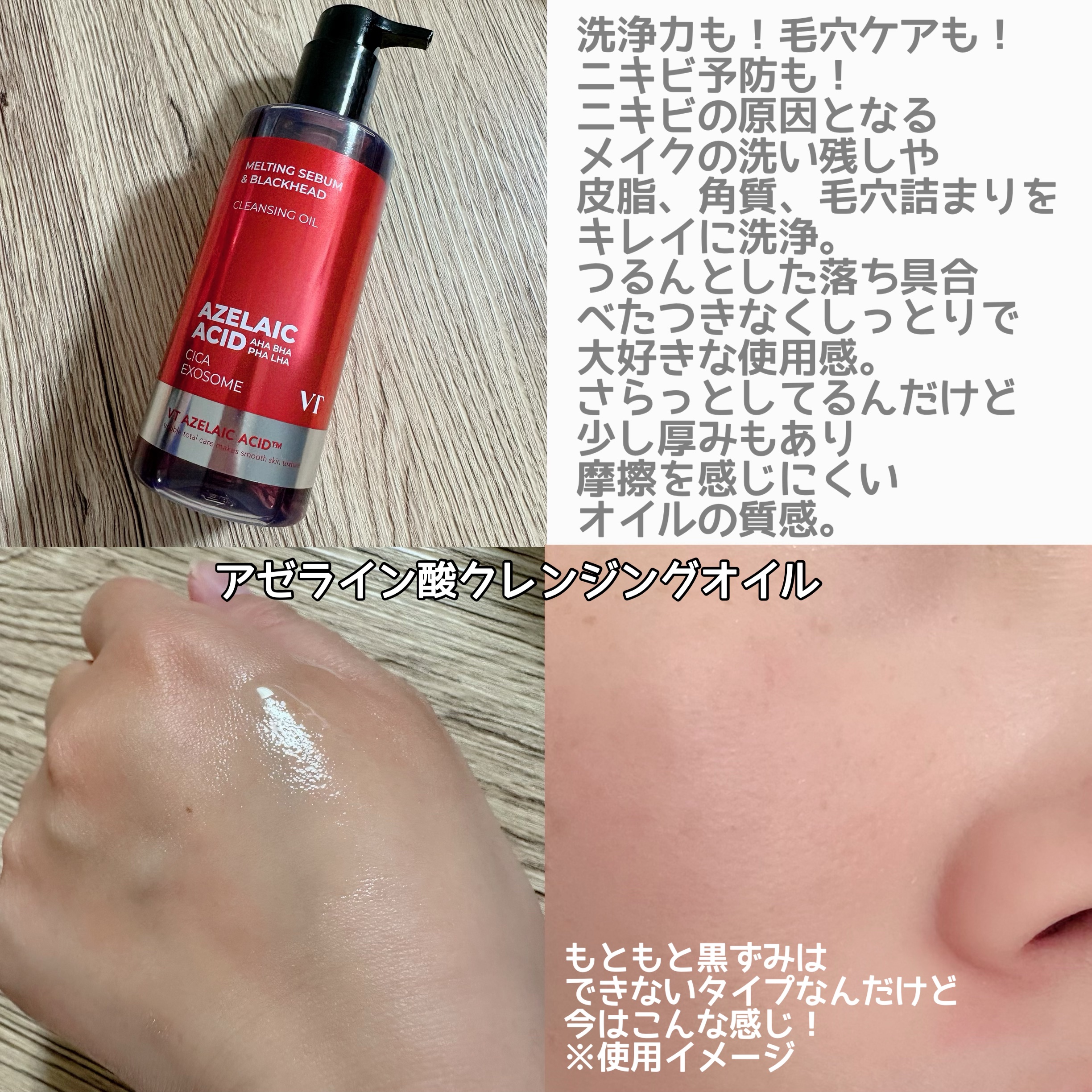 AZケア クレンジングオイル/VT/オイルクレンジングを使ったクチコミ（2枚目）