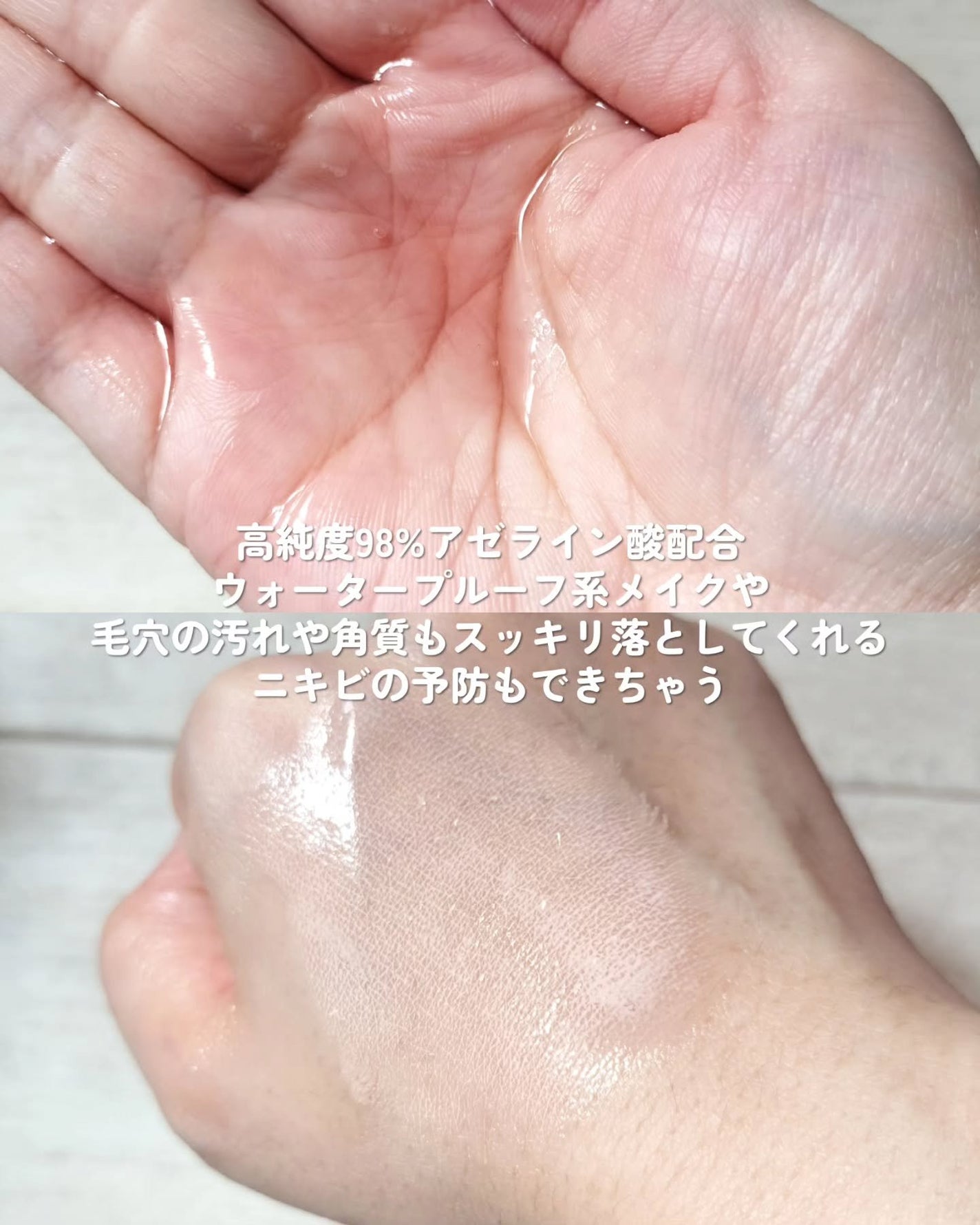 AZケア クレンジングオイル/VT/オイルクレンジングを使ったクチコミ(5枚目)