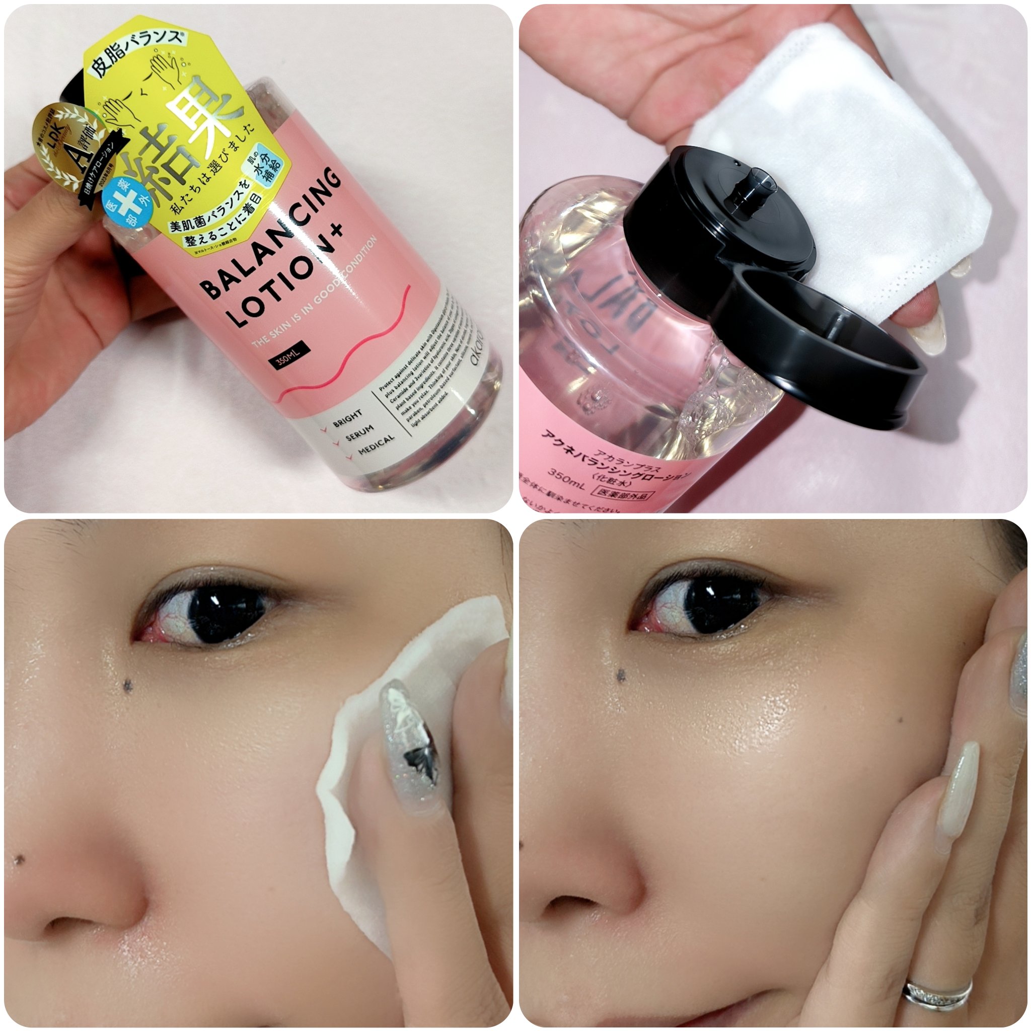 バランシングローション /アカラン/化粧水を使ったクチコミ（3枚目）