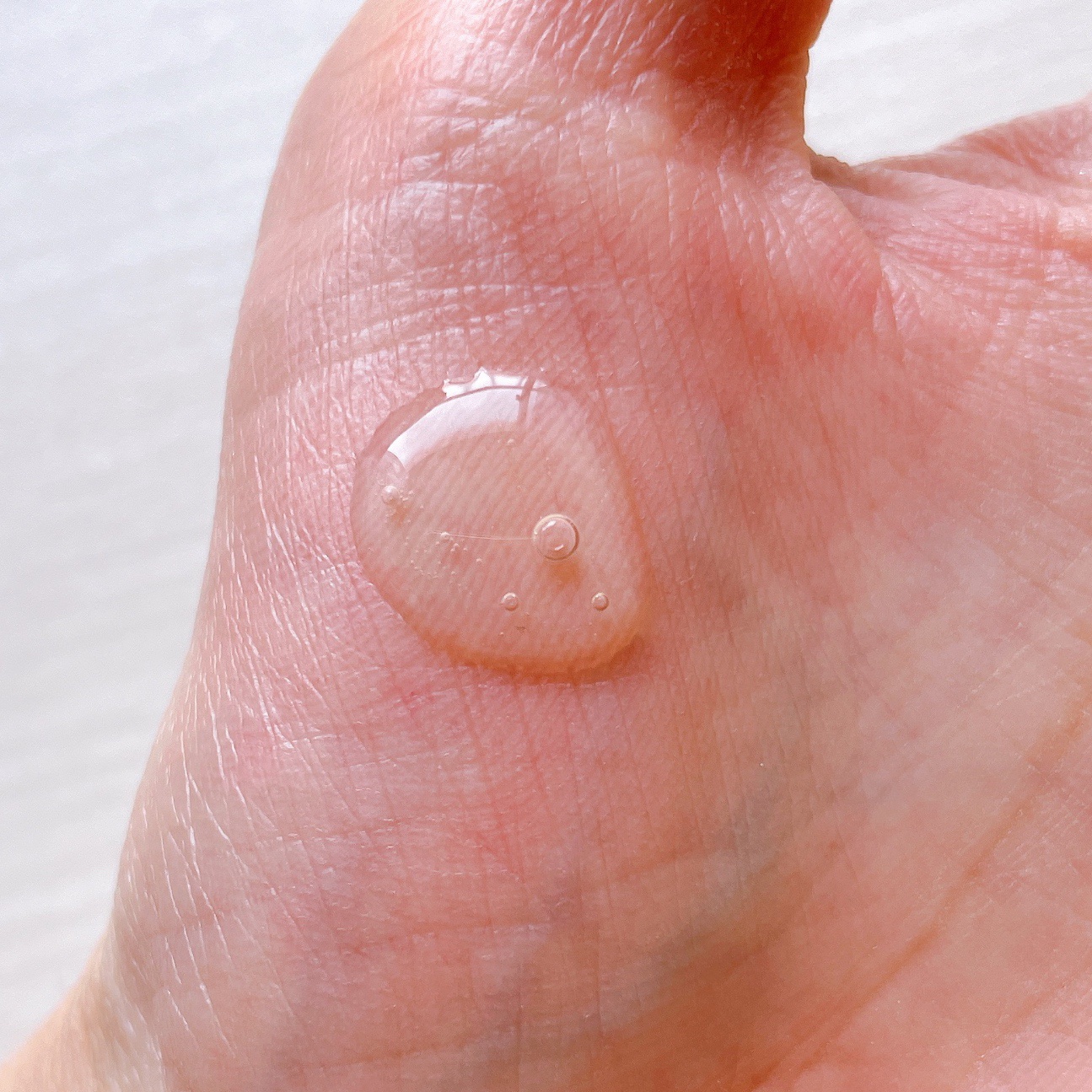 ベターツリカン肌荒れ美容液/Mildlab/美容液を使ったクチコミ（2枚目）