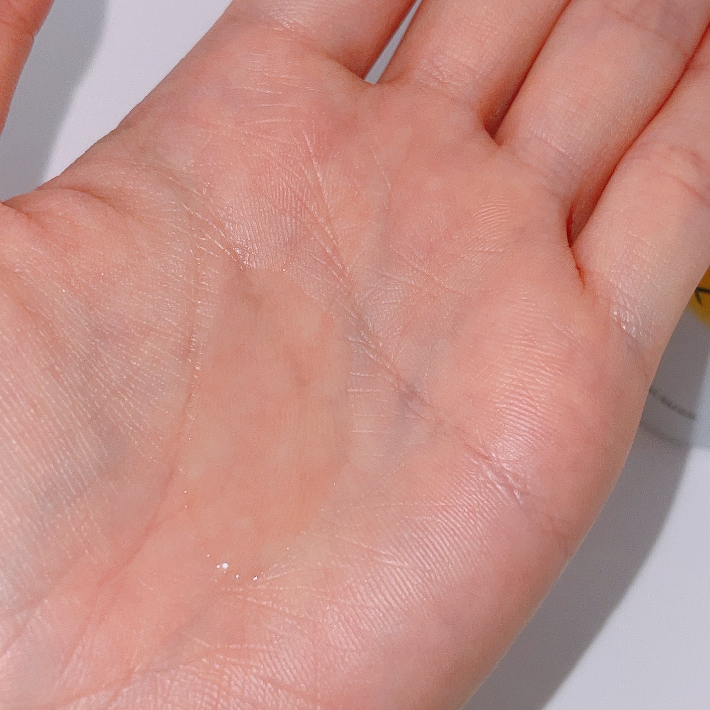 VC ホワイトピールセラム/SKIO/ブースター・導入液を使ったクチコミ(2枚目)