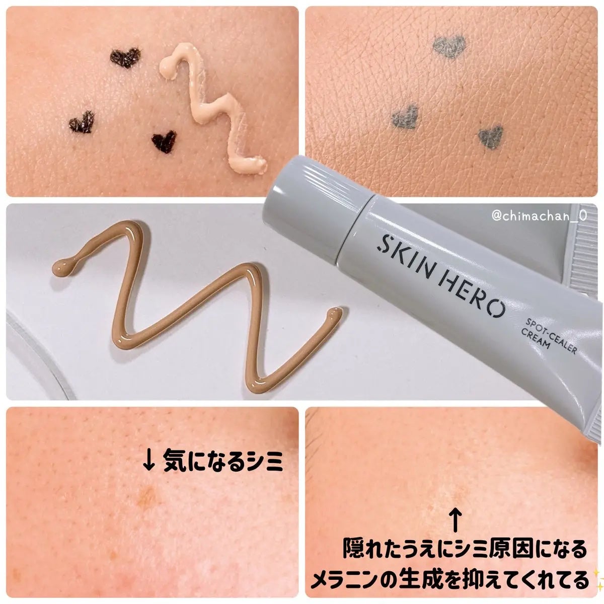 薬用スポットシーラークリーム/スキンヒーロー/クリームコンシーラーを使ったクチコミ(2枚目)