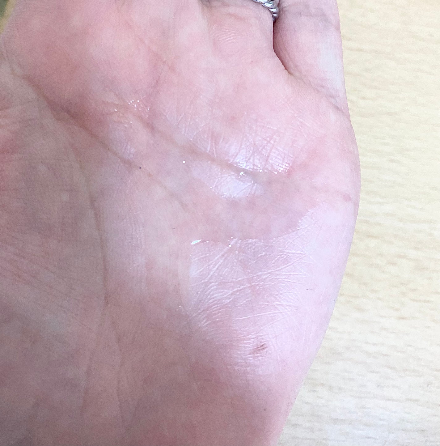 センテラ アンプル/SKIN1004/美容液を使ったクチコミ(3枚目)