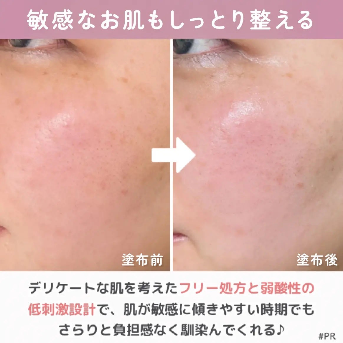 薬用ローション センシティブEX/ドクターシーラボⓇ/化粧水を使ったクチコミ(5枚目)