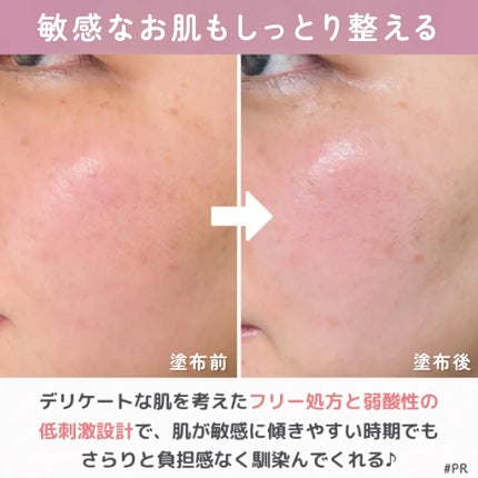 薬用ローション センシティブEX/ドクターシーラボⓇ/化粧水を使ったクチコミ(5枚目)