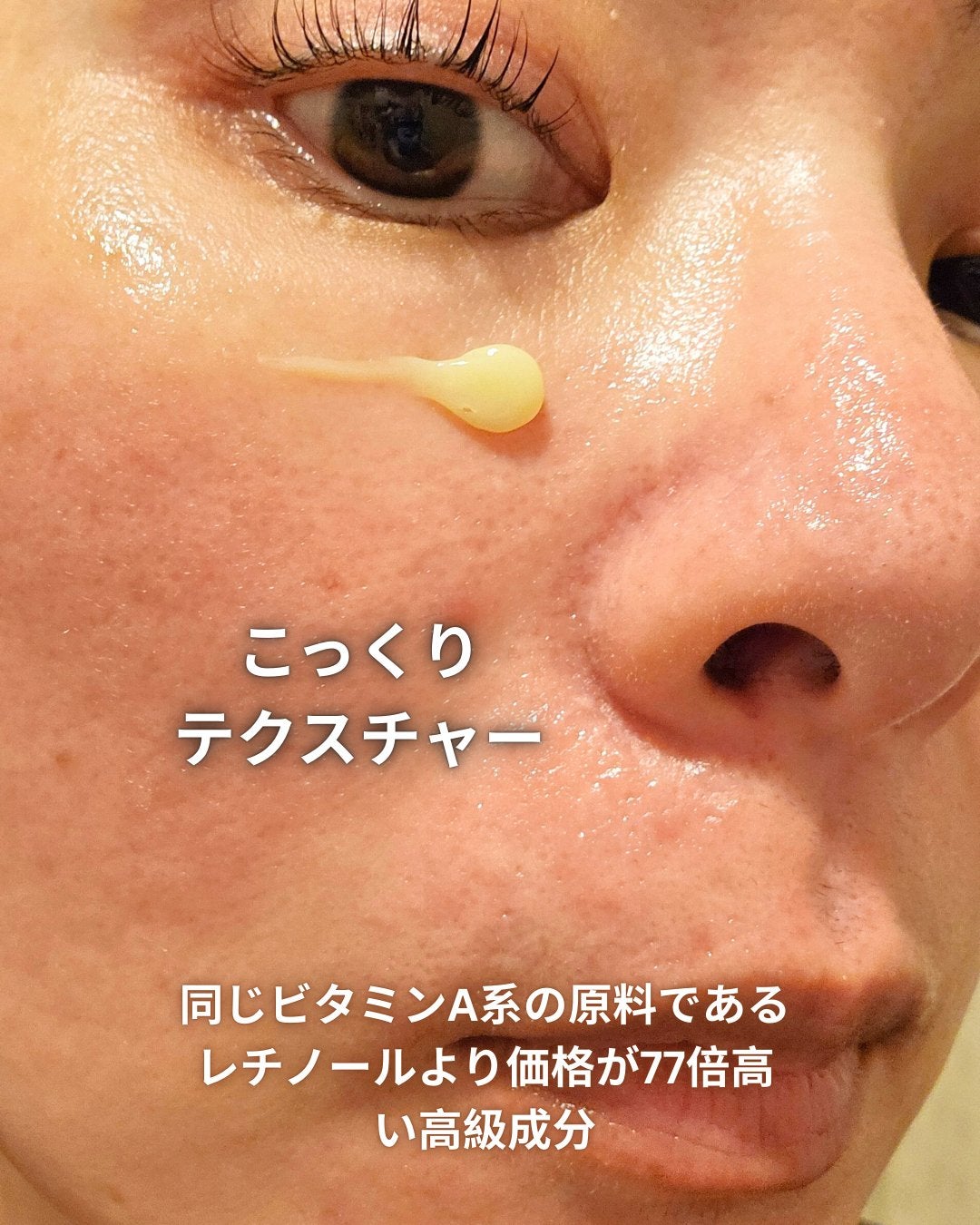 VITALIFT A forte/Dr.Different/フェイスクリームを使ったクチコミ(2枚目)