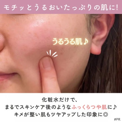 薬用ローション センシティブEX/ドクターシーラボⓇ/化粧水を使ったクチコミ(6枚目)