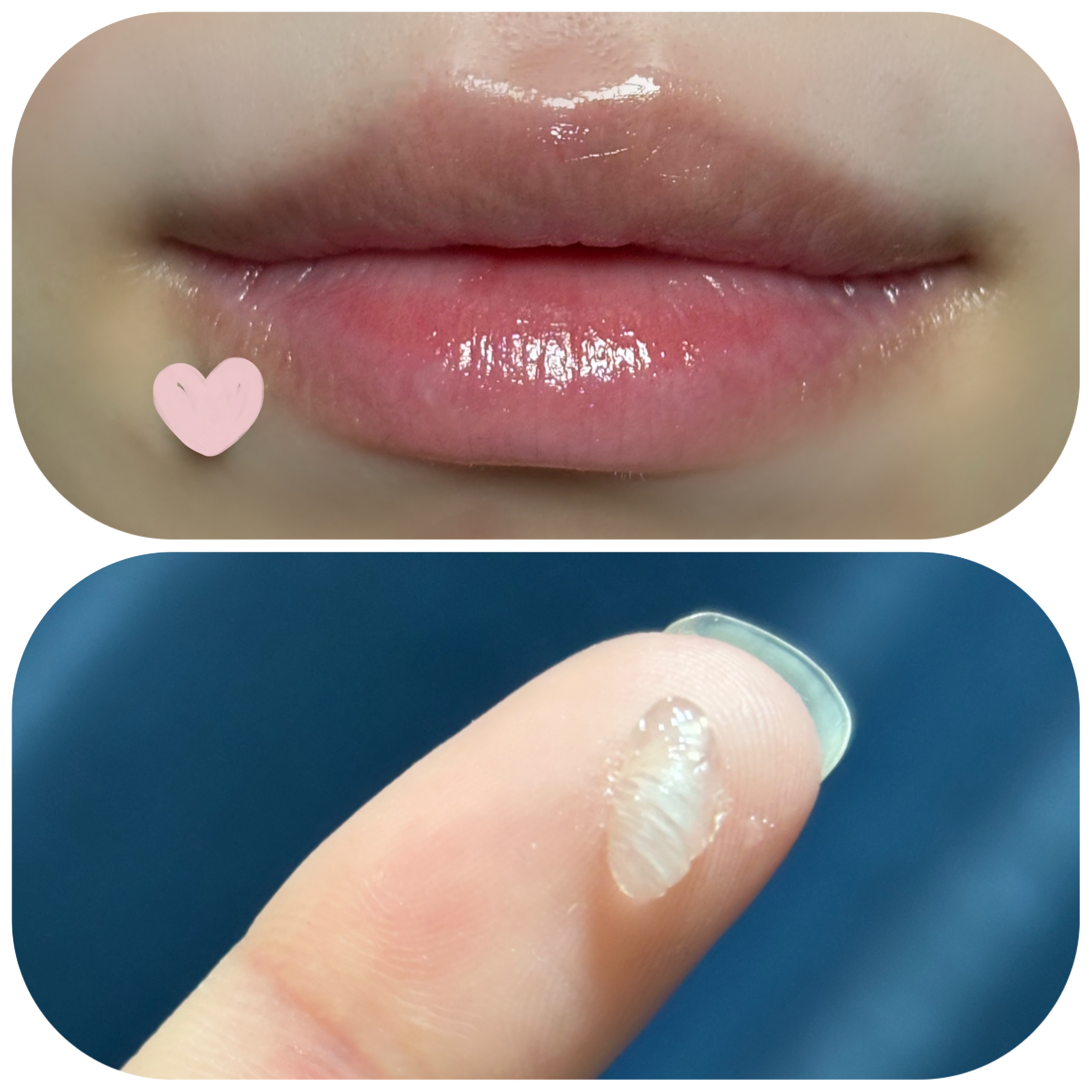 リップセラムパック/ビフェスタ/リップマスクを使ったクチコミ（3枚目）