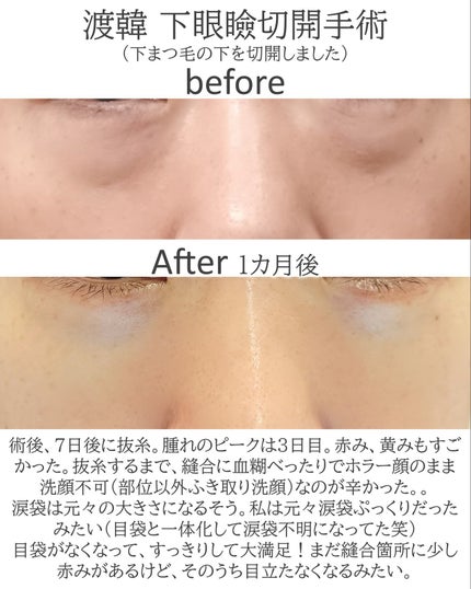 を使ったクチコミ(1枚目)