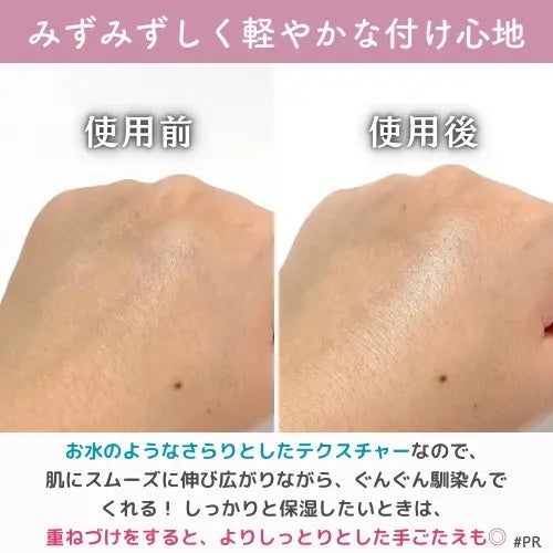 薬用ローション センシティブEX/ドクターシーラボⓇ/化粧水を使ったクチコミ(4枚目)