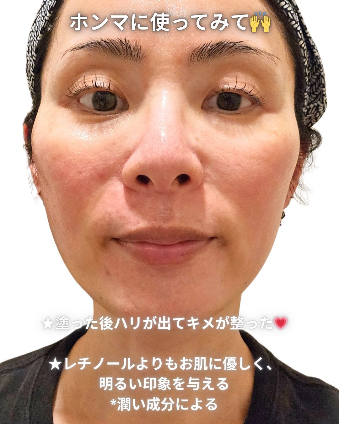 VITALIFT A forte/Dr.Different/フェイスクリームを使ったクチコミ(4枚目)