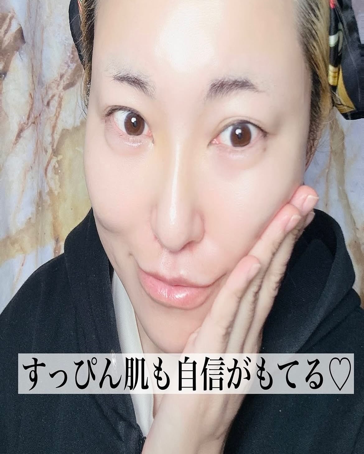 PDRNヒアルロン酸カプセル100セラム/Anua/美容液を使ったクチコミ(5枚目)