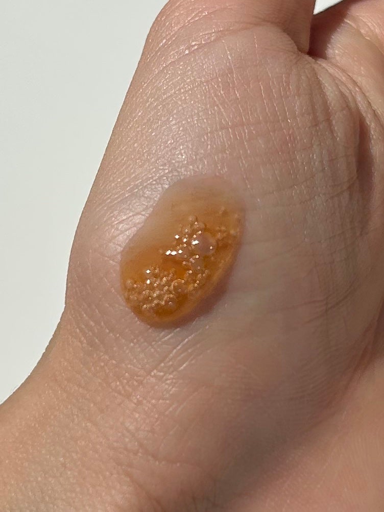 ダブル セーラム ADC/CLARINS/美容液を使ったクチコミ(2枚目)