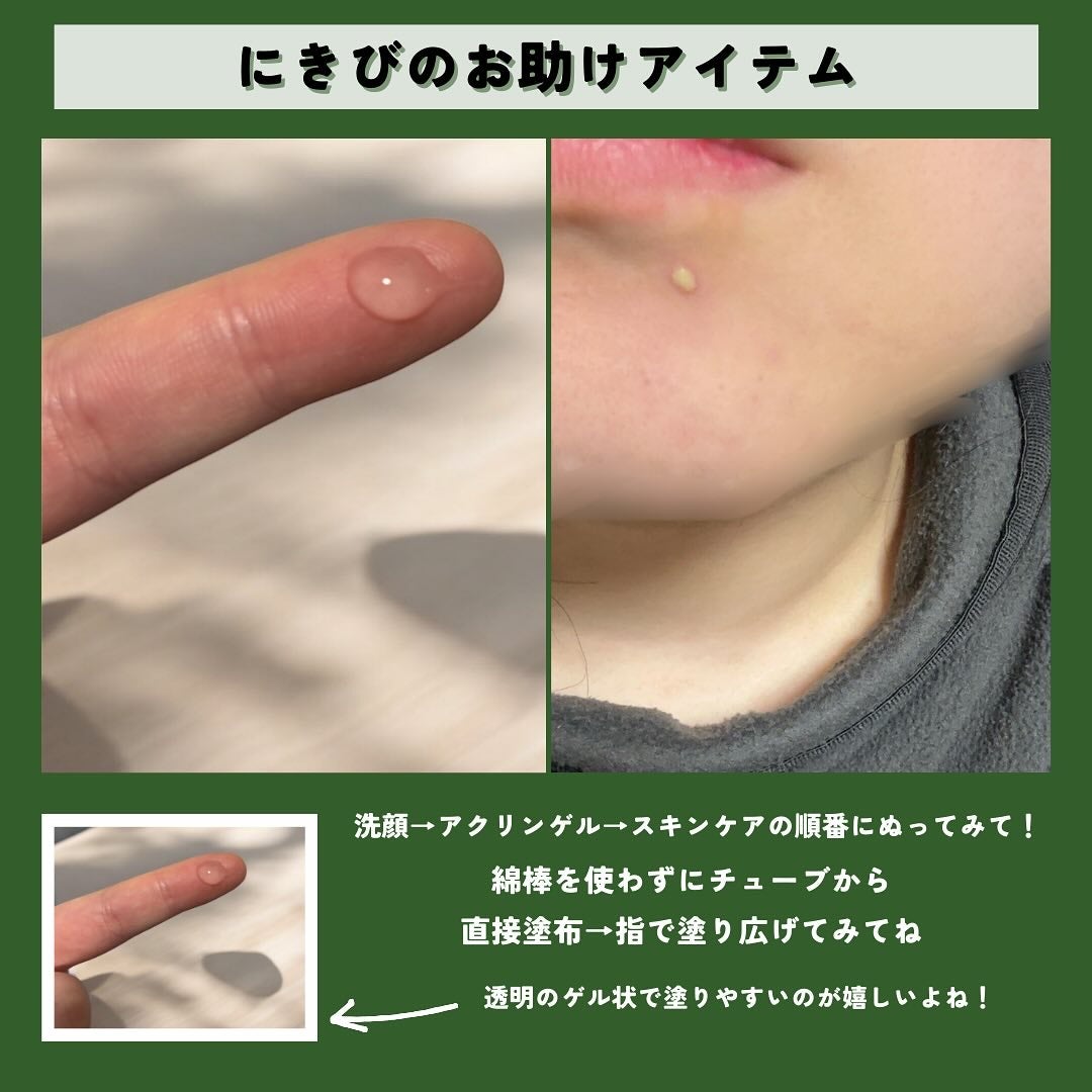 アクリンゲル/東亜製薬/その他スキンケアを使ったクチコミ(3枚目)