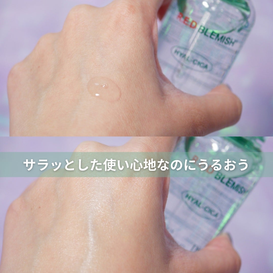 レッドブレミッシュ クリアスージングクリーム/Dr.G/フェイスクリームを使ったクチコミ(3枚目)