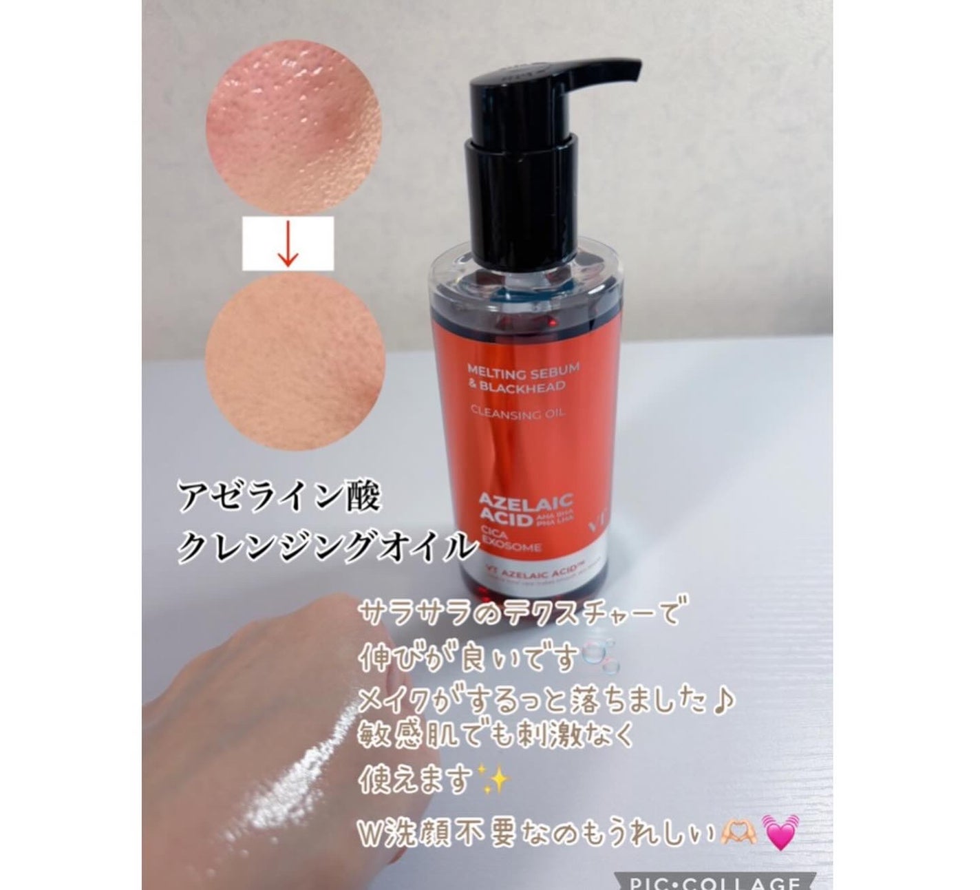 コハル フォロバ on LIPS 「VTさんのモニターで︎︎◌アゼライン酸シリーズ▫️アゼライン酸..」(2枚目)