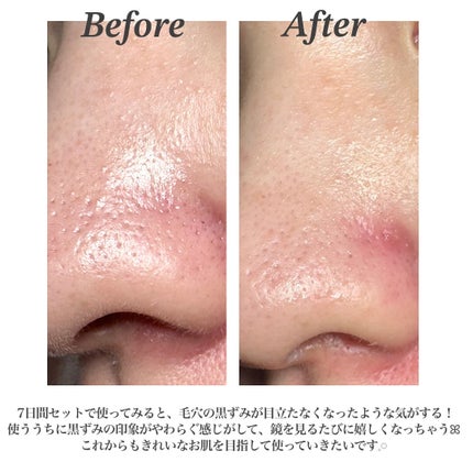 AZケア クレンジングオイル/VT/オイルクレンジングを使ったクチコミ(4枚目)