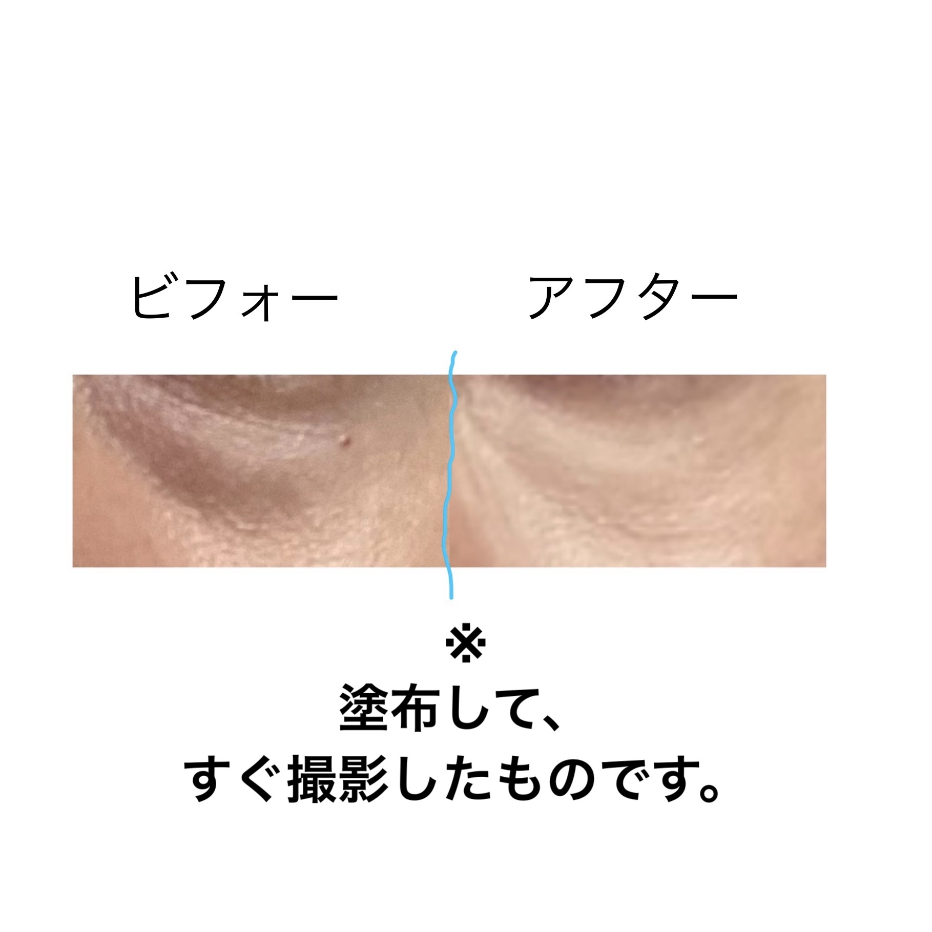 ディオールスキン フォーエヴァー スキン コレクト コンシーラー/Dior/リキッドコンシーラーを使ったクチコミ（2枚目）