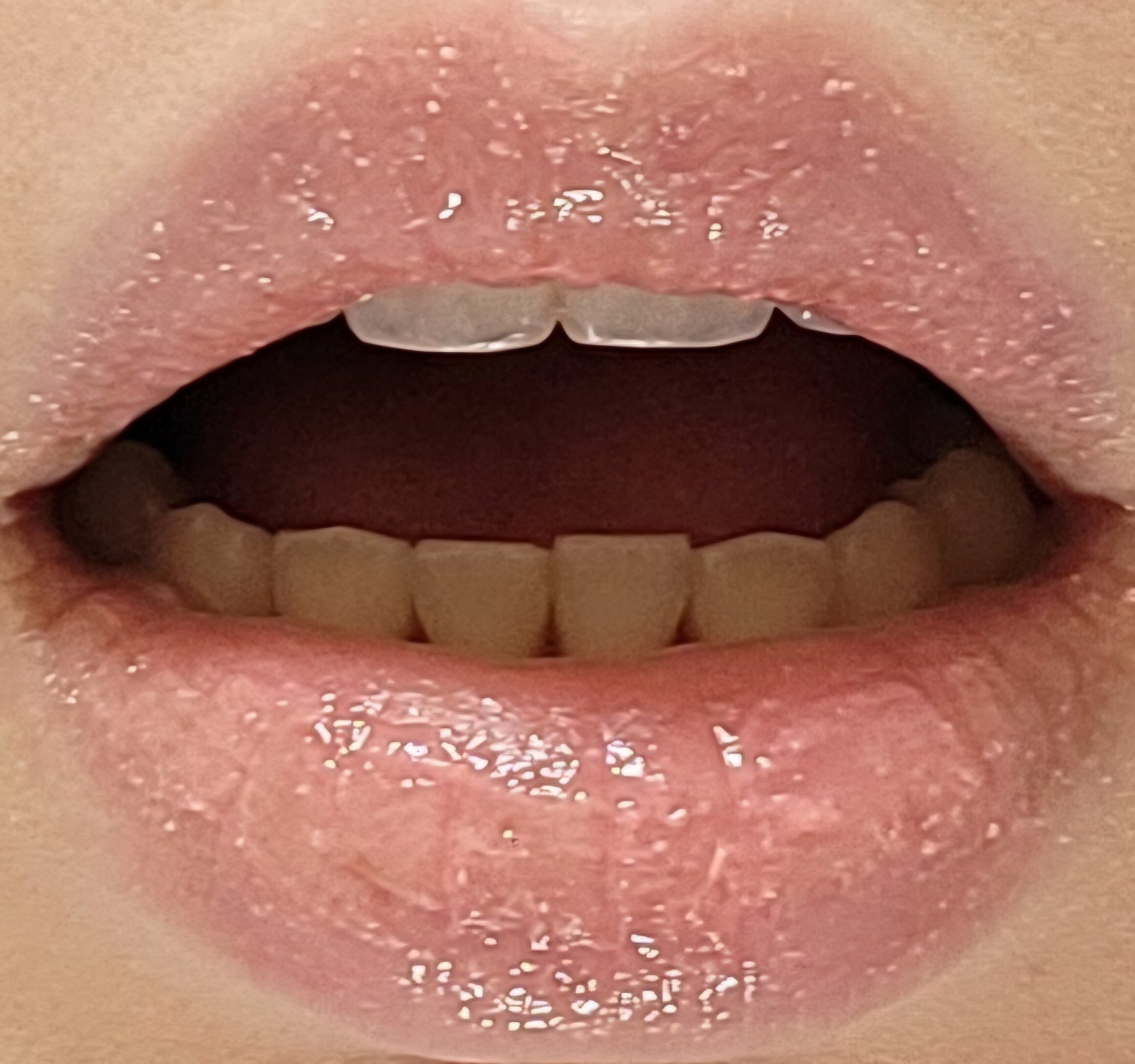 リップケアスクラブ/GENE TOKYO/リップスクラブを使ったクチコミ（1枚目）