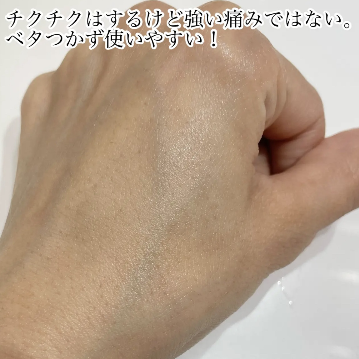 ビディ ニードルエッセンス NN/ビディ/美容液を使ったクチコミ（3枚目）